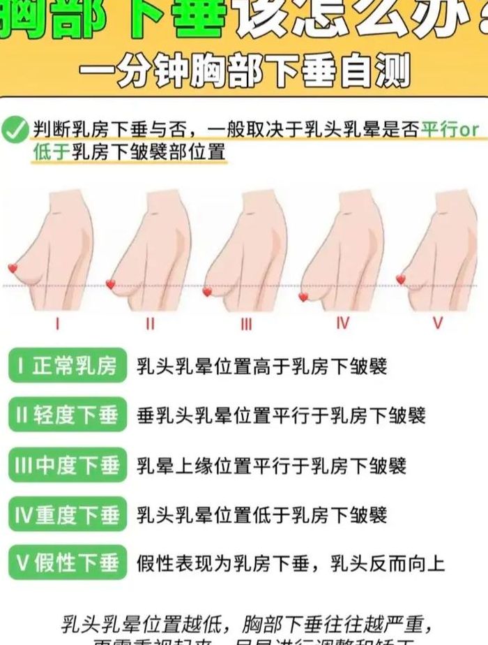 胸下垂还很软怎么改善（胸下垂还很软怎么改善?）