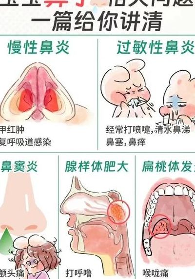 儿童有鼻窦炎该怎么治疗（儿童有鼻窦炎有什么症状）