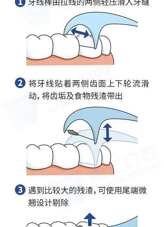 牙线的使用方法（技能考试牙线的使用方法）