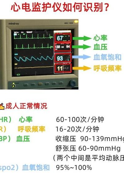 心电监护仪显示器图解（心电监护仪显示器图解 血压）