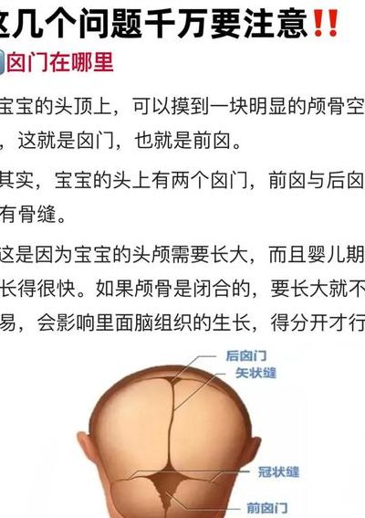 婴儿卤门对照表图（婴儿卤门在哪个位置图）